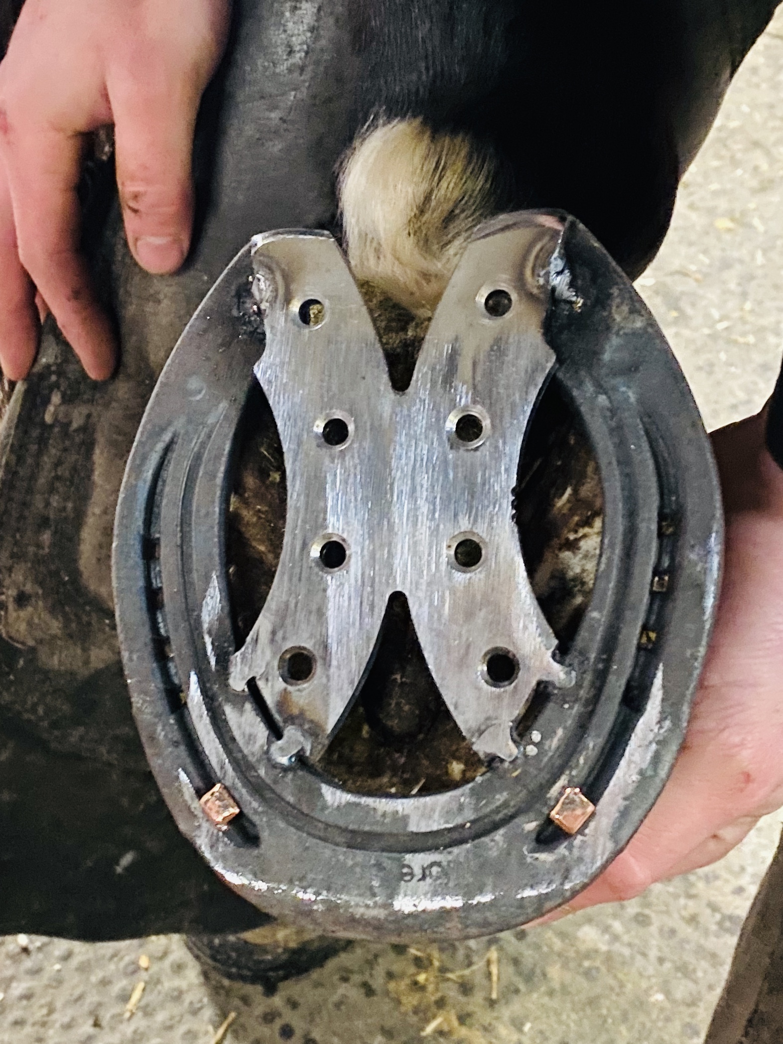 Acute PDSL DESMOPATHY